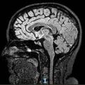 Profile picture encephalophagy.bsky.social